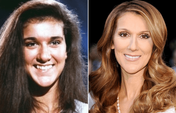 Czy każda operacja plastyczna sprawia, że wygląda się lepiej? Zobaczcie kto trochę z zabiegami przesadził...