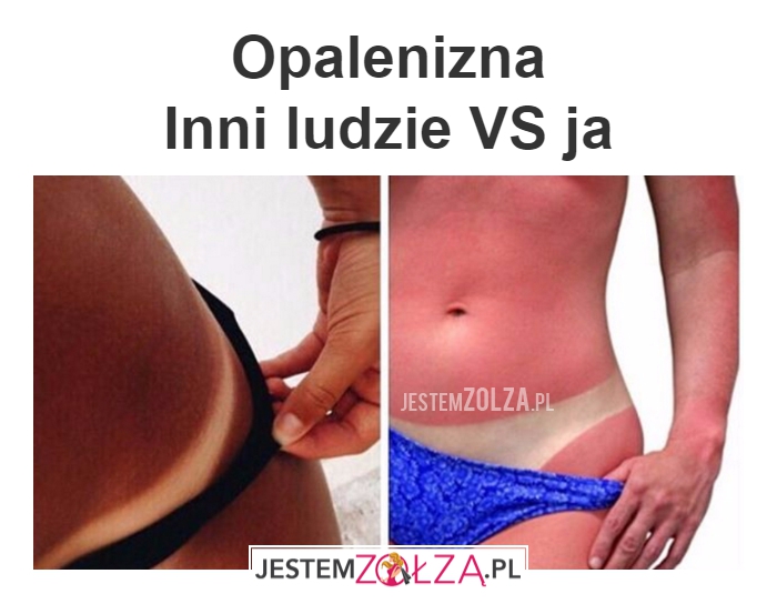 opalenizna