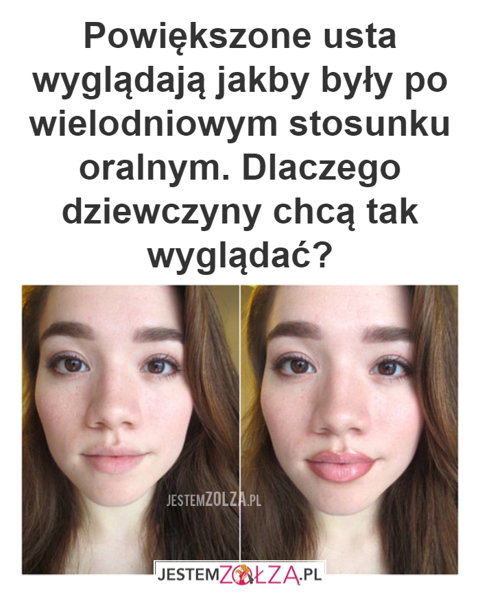 Powiększone usta wyglądają