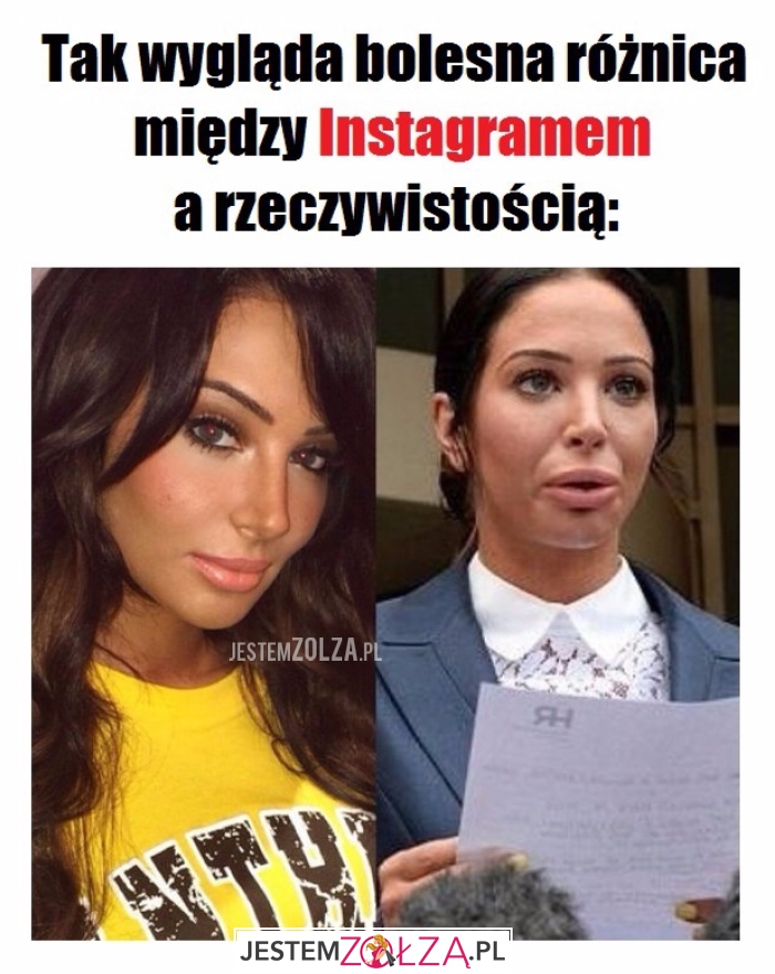 Bolesna różnica