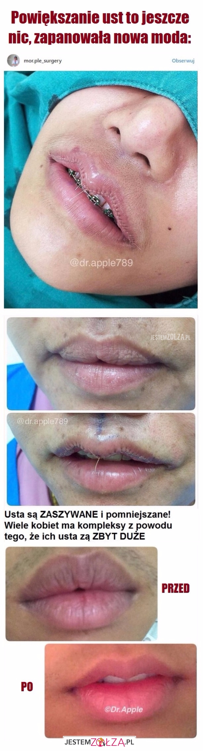 Powiększanie ust...