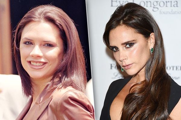 Te gwiazdy poddały się operacjom kości policzkowych (7	obrazków)