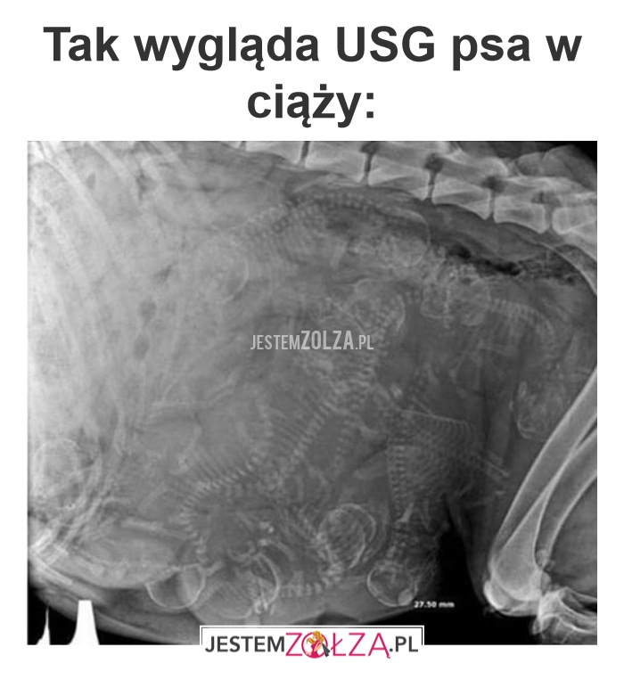 Tak wygląda USG