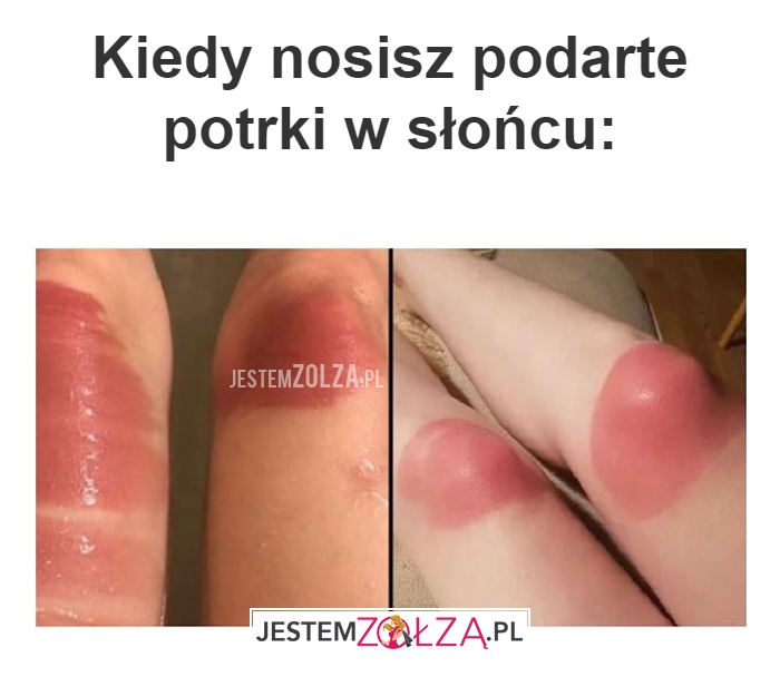 Kiedy nosisz podarte 